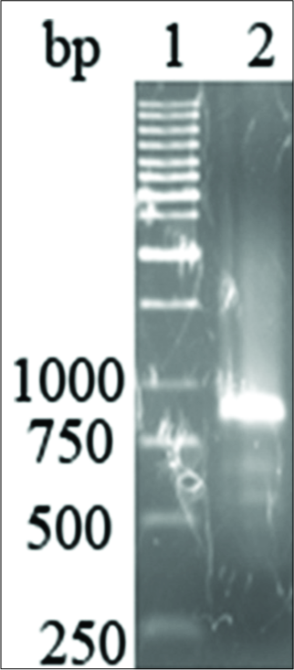The human bone morphogenetic protein 7 (BMP7) gene that was amplified from human cDNA was the expected size of 760 bp
