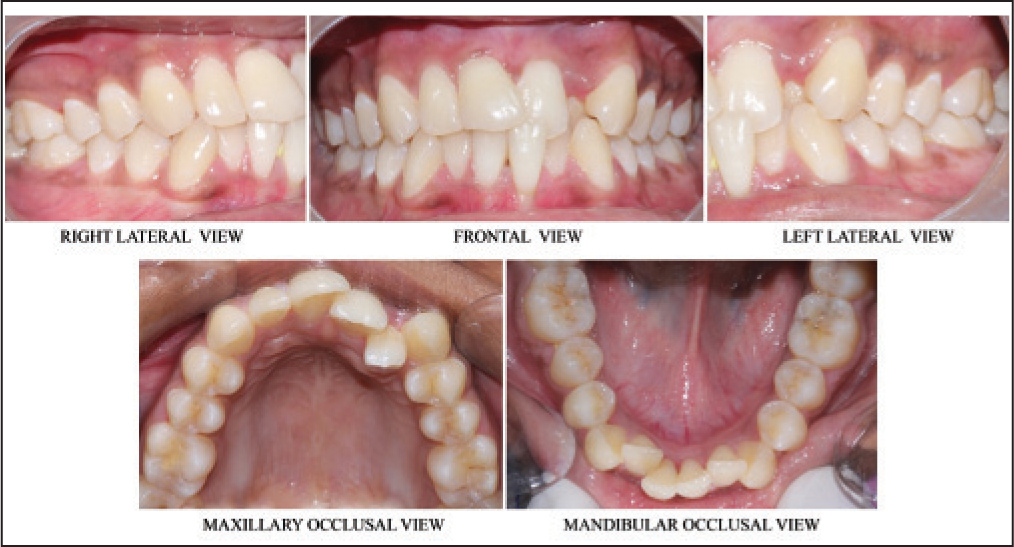 Pre-treatment intra-oral photographs