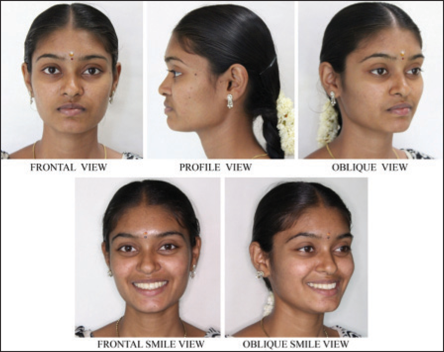 Post-treatment extra oral photographs