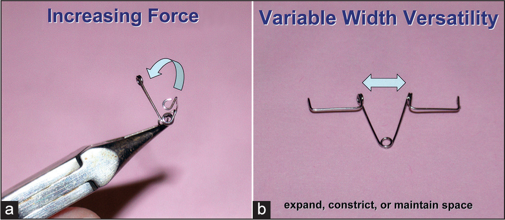 (a) The force produced by the Kilroy Spring can be adjusted by simply bending the vertical loop away from the impacted tooth (more force) or towards the tooth (less force). (b) The Kilroy Spring can be expanded or constricted to fit the available arch length where the impacted tooth is missing or to produce some mild forces for opening or closing that space