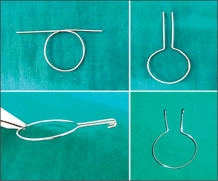 Fabrication of “O” device