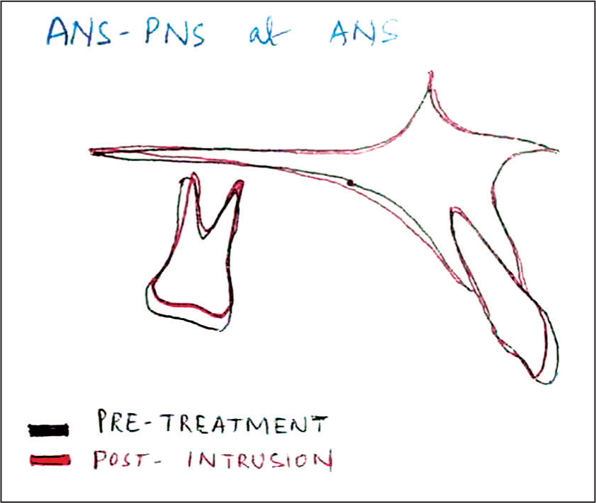 Cephalometric superimpositions