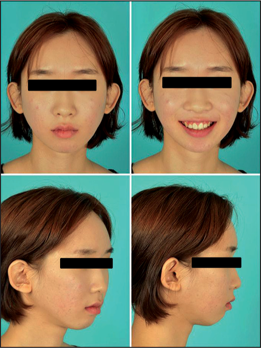 Posttreatment extra-oral photographs
