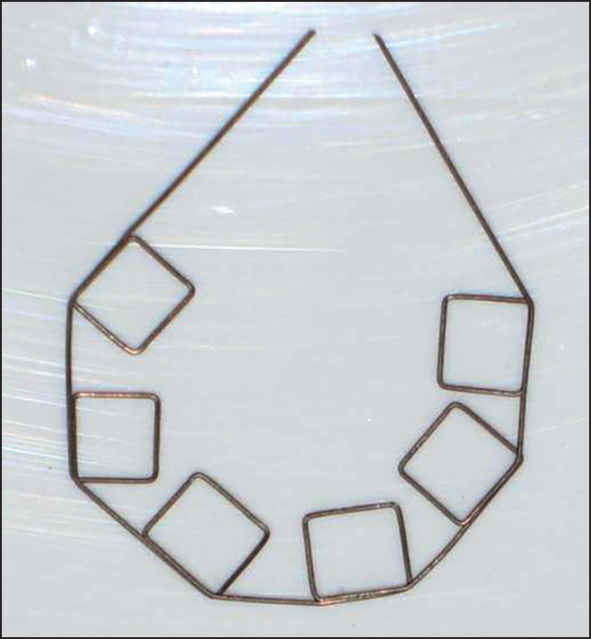 Design of Mollenhauer aligning auxiliary using 0.009” Supreme Australian wire*