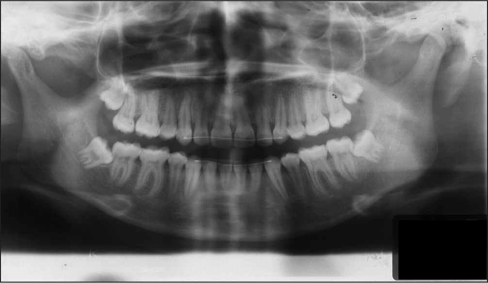 Post-treatment orthopantamogram