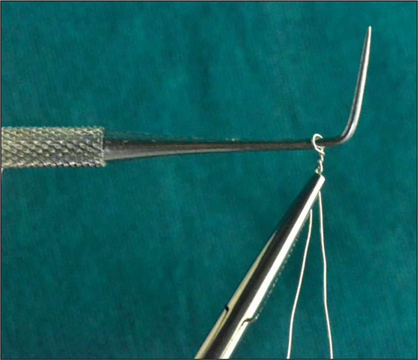 0.014″ ligature wire twisted around the neck of a probe using Mathieu’s needle holder to form a loop