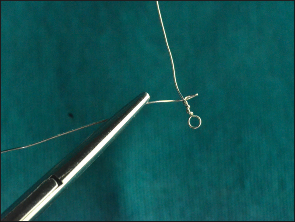 Small horizontal offshoot of the ligature wire twisted at right angles on either side of the vertical segment of the wire