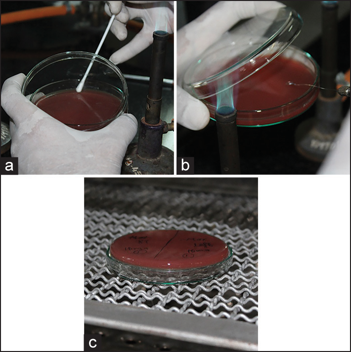 (a-c) Plaque swab inoculation in petridish and incubation at 37° for 48 h respectively