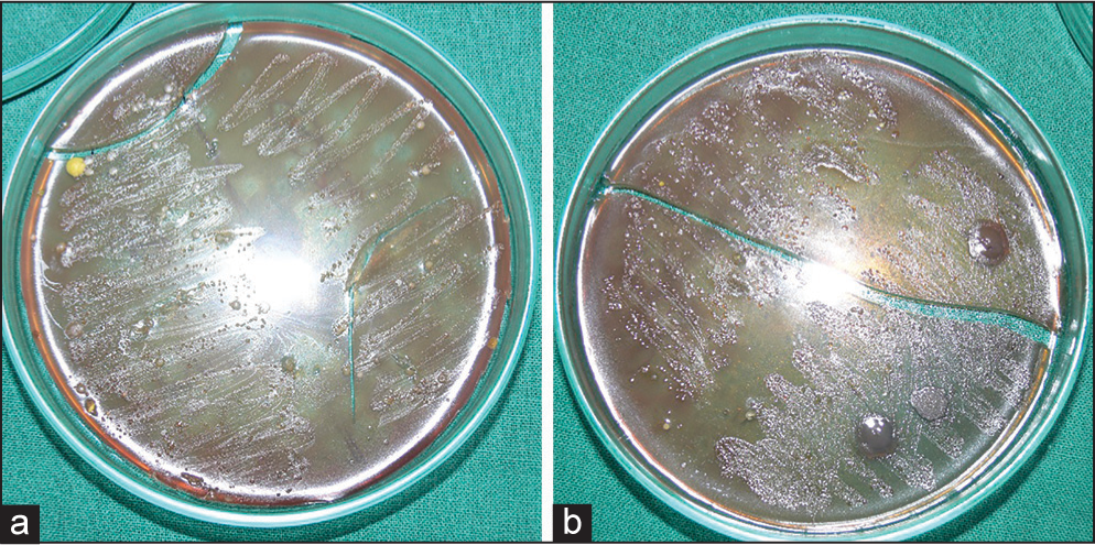 Streptococcus mutans growth at the beginning (a), at 30 days (b)