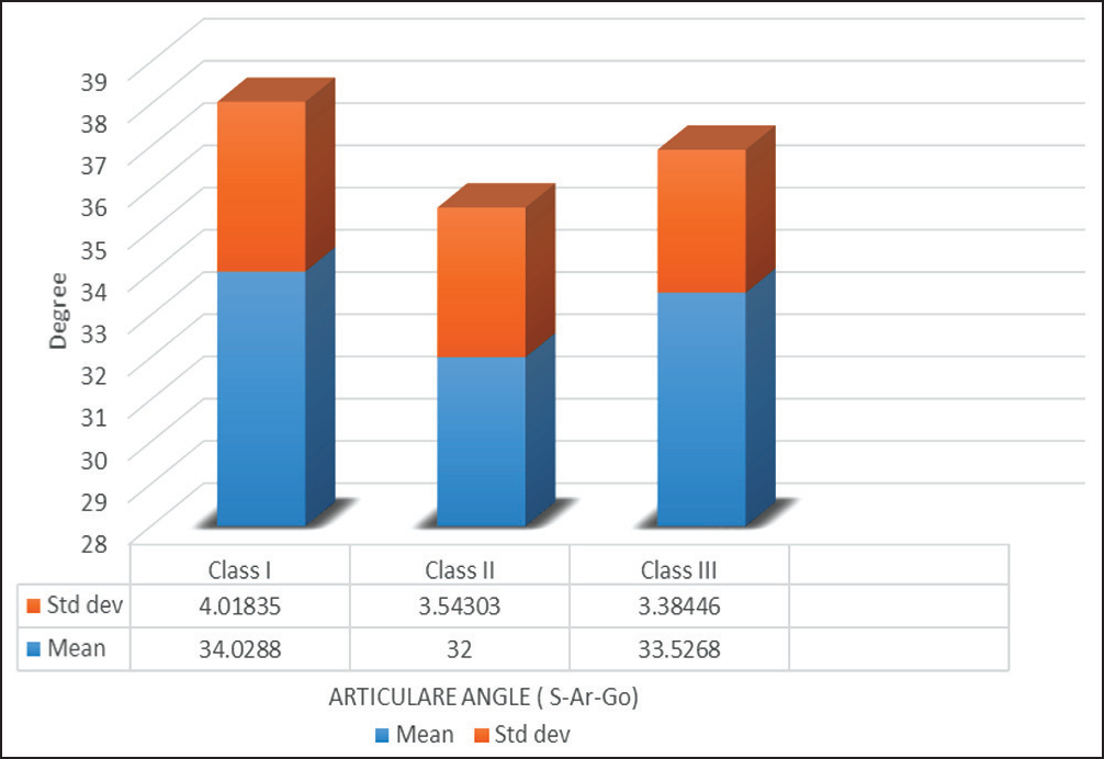 Articular angle (degree) values for three malocclusion classes