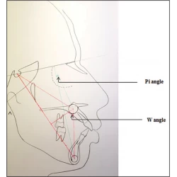 Article figure