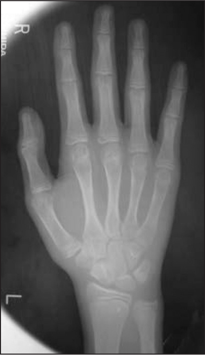 Pretreatment hand/wrist radiograph