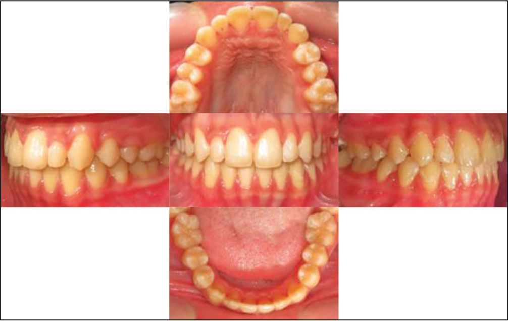 Posttreatment intra-oral photographs