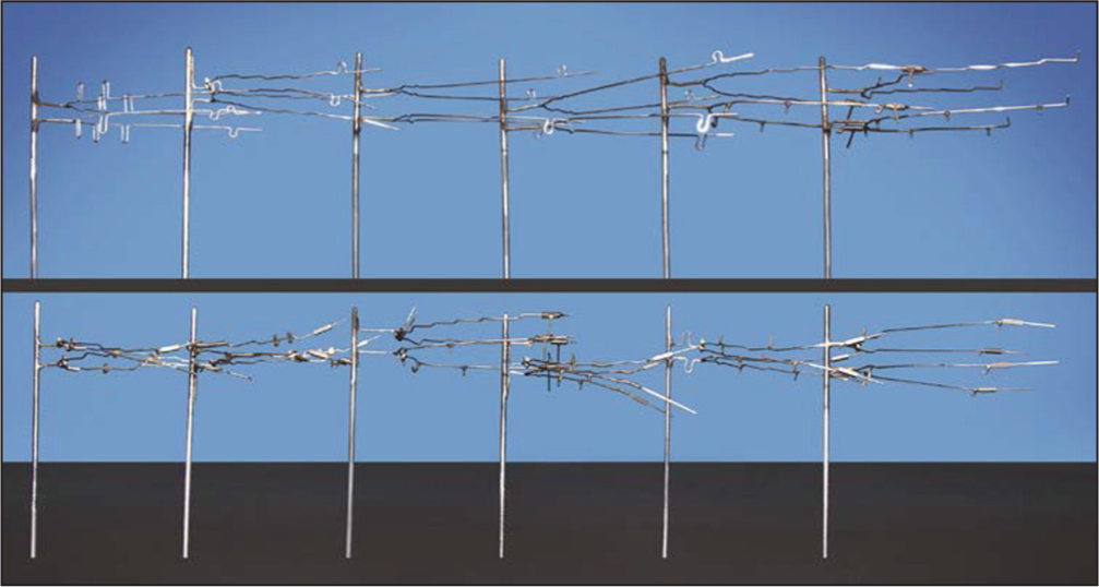 Twelve sets of archwires