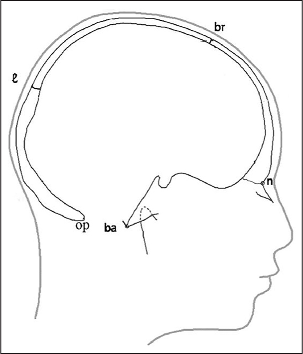 Outline of the profile radiograph. Four points: Nasion, bregma, lambda, and opisthion divide the skull into three areas to be measured