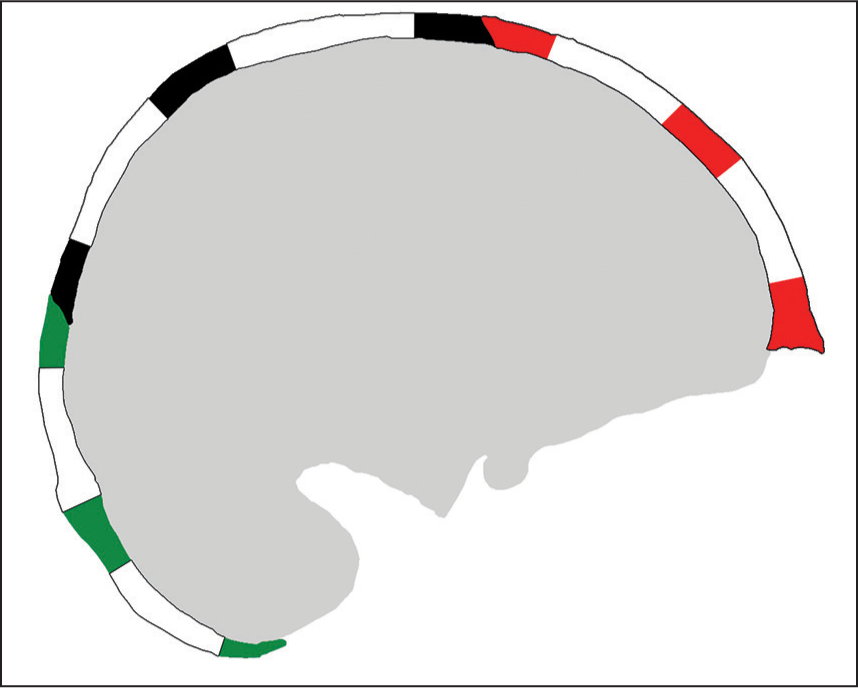 Colored areas representing the three different sections in bones of the skull