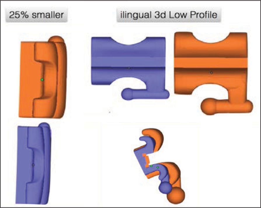 iLingual 3D low profi le 25% smaller