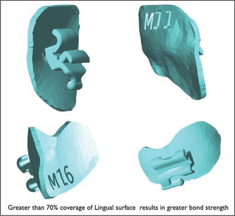 Resin out puts after rapid prototyping with tooth number engraved for identifi cation