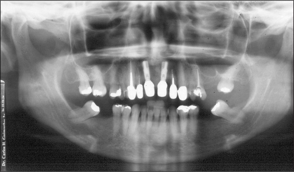 Pretreatment panoramic radiograph