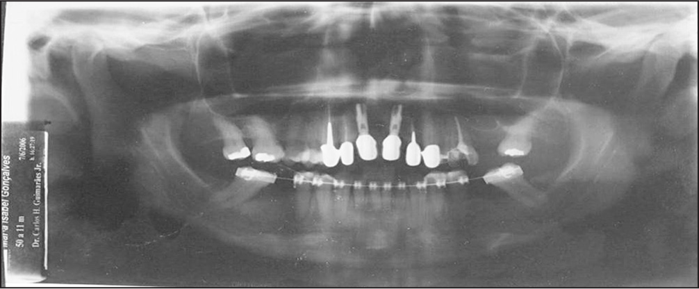 Posttreatment panoramic radiographs