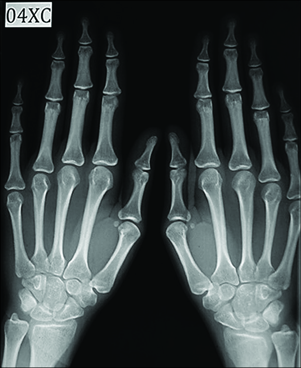 Hand–wrist radiograph