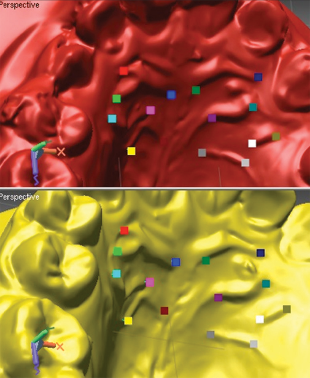 Split screen allows simultaneous viewing of yellow pretreatment and crimson posttreatment scans