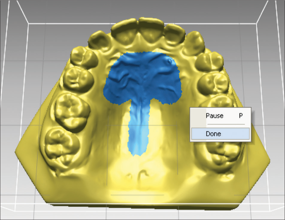 Mushroom-shaped area outlined for more detailed superimposition