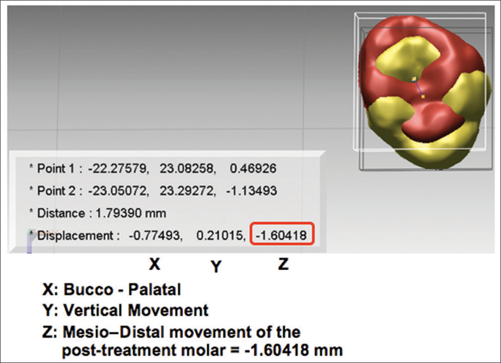 Centers of mass of molar crowns was identified and movement was calculated in three-dimension