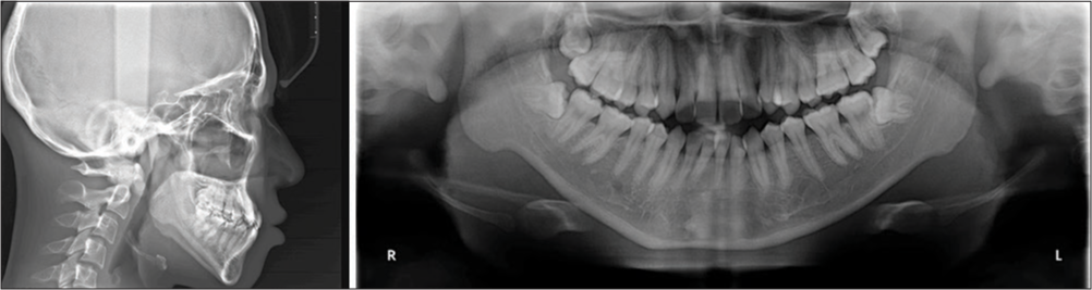 Cephalogram and orthopantomogram