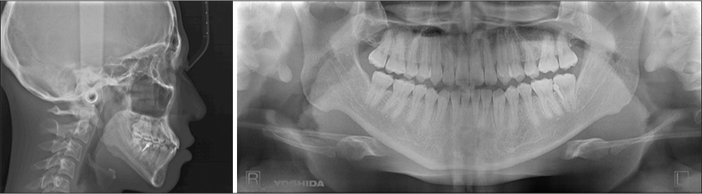 Cephalogram and orthopantomogram