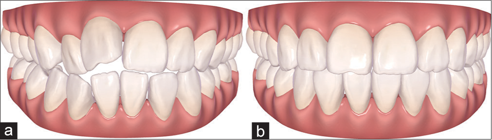 Clinical check (a) initial and (b) final