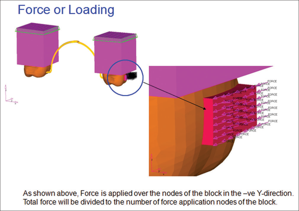 Simulation of orthodontic force application on the model
