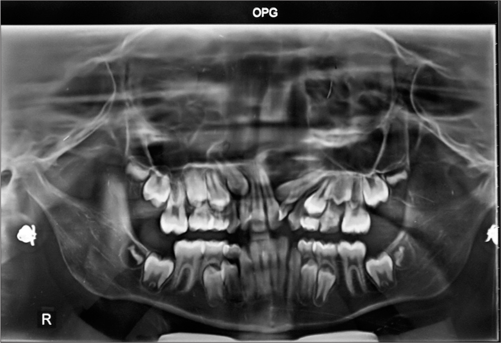 Pretreatment orthopantomogram