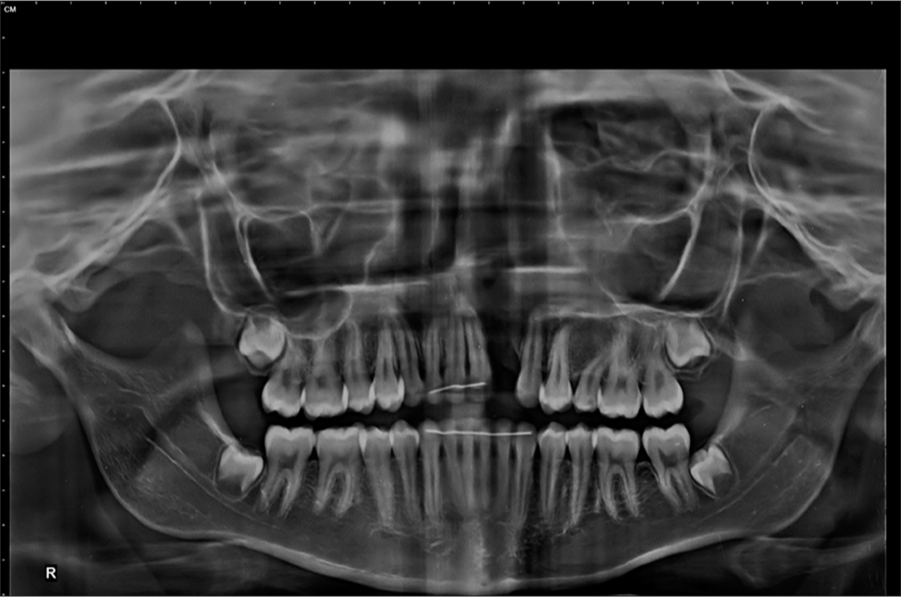 Posttreatment orthopantomogram