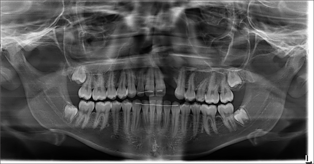 1-year follow-up Orthopantomogram