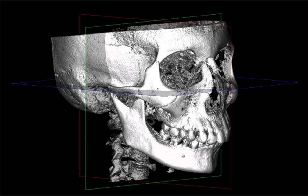 Cone beam computed tomography image orientation