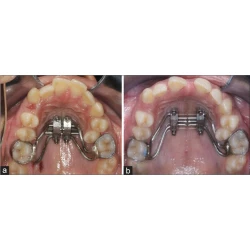 Article figure