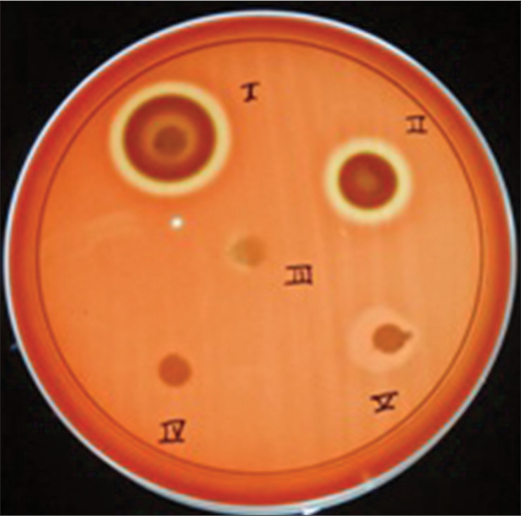 Agar diffusion test to detect antibacterial activity of self-etching primers against Lactobacillus acidophilus