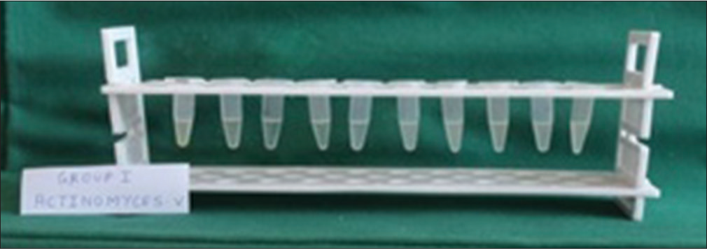 Minimum inhibitory concentration of Transbond plus self-etching primer against Actinomyces viscosus