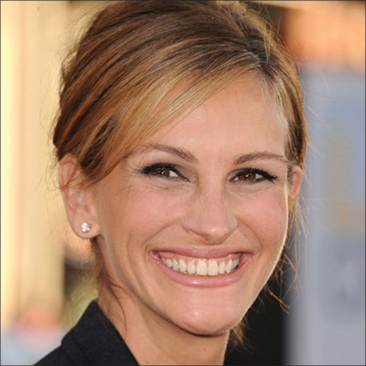 The much admired smile of Hollywood actress Julia Roberts