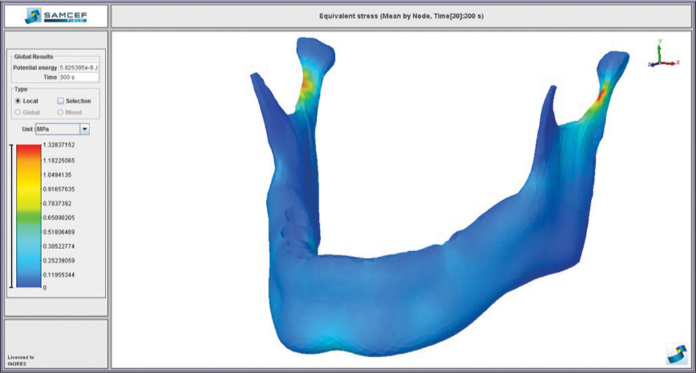 Von Mises stress distribution on the mandible