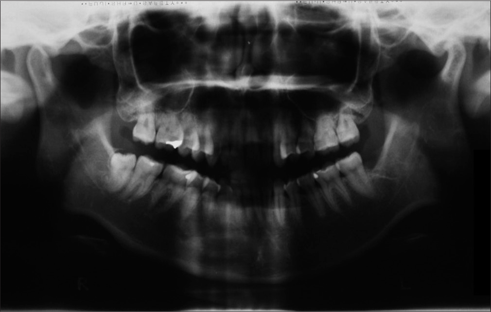 Pretreatment panoramic radiograph