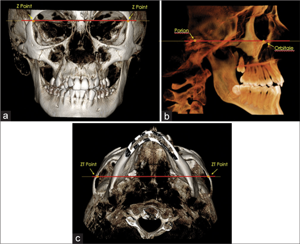 CBCT orientation on the a) coronal plane; b) sagittal plane; and c) axial plane