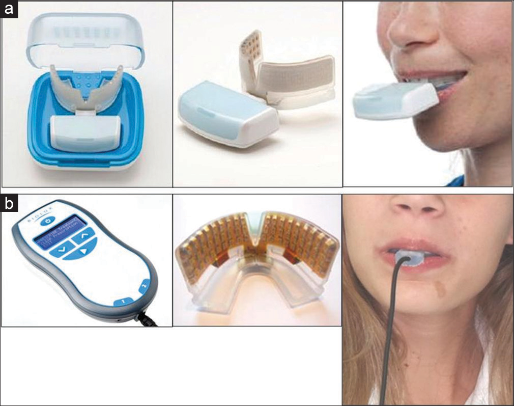 (a) Treatment group: Wireless OrthoPulse® comprised wireless mouthpiece case, power supply, and patient usage. The wireless experimental device emitted infrared incoherent light-emitting diode light of 850 nm wavelength. (b) Control group: Wired OrthoPulse® device comprised controller and electrical power supply, mouthpiece, and patient usage. The wired control device was a placebo and did not emit any infrared light