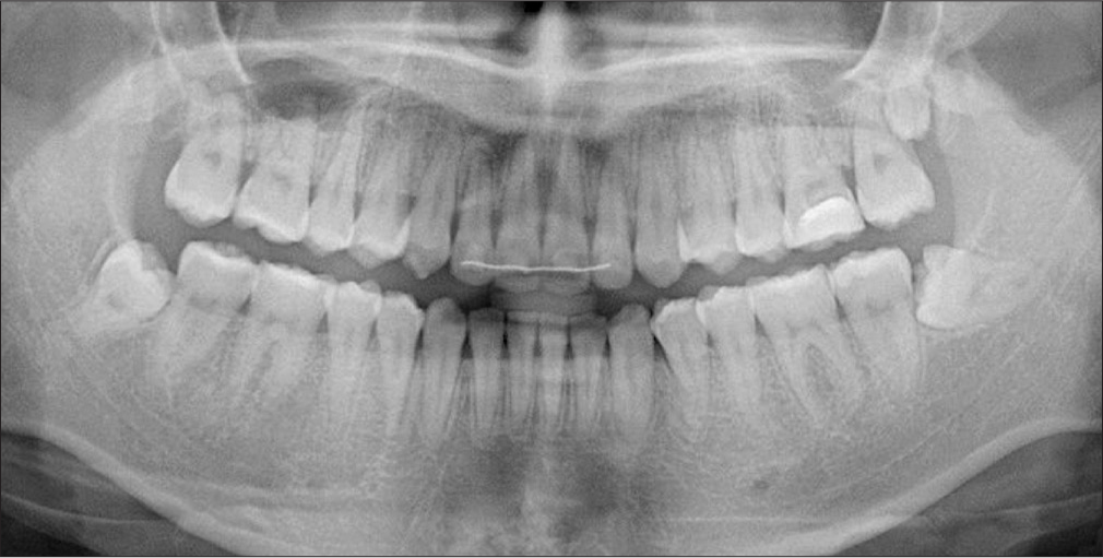 Posttreatment panoramic radiograph