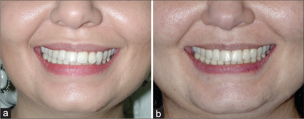 (a) The case before treatment. (b) After treatment