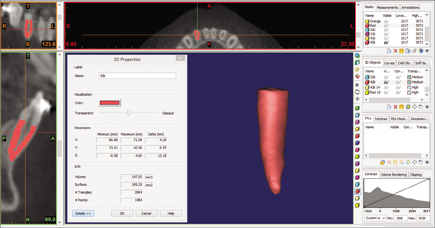 Volumes were measured from the cementoenamel junction to the tip of the apex. Root volumes were calculated automatically using the software.
