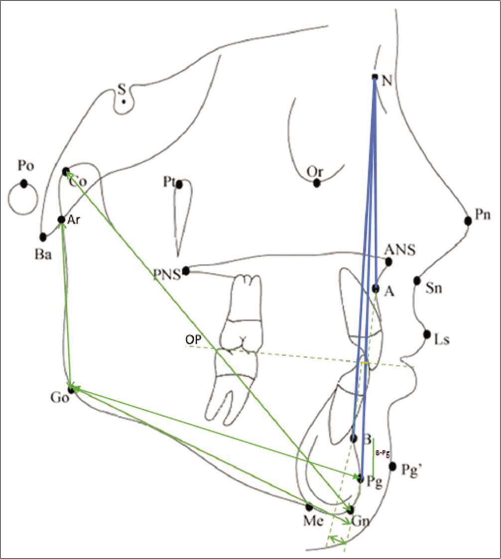 Mandibular skeletal parameters (ii)- A) Co-Gn, B) Ar-Go, C) Go-Pg and D) B-Pg. Maxillo-mandibular parameters- A) ANB, B) N-A-Pg and C) Wits appraisal.