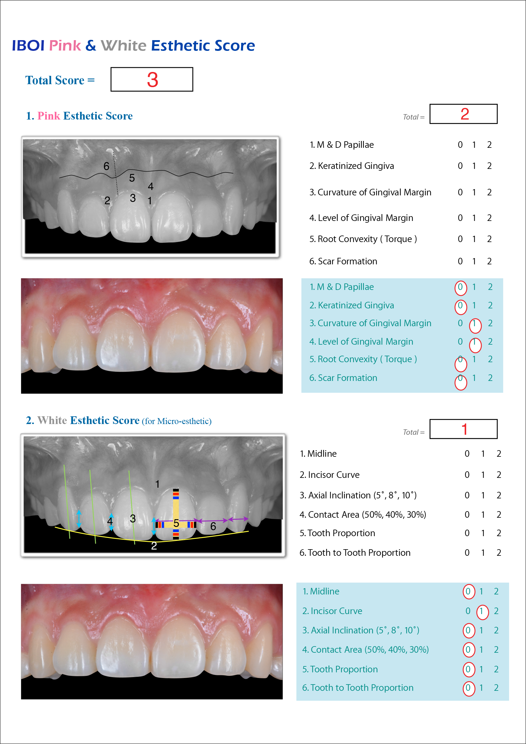 Pink & White Esthetic Score (P&W)