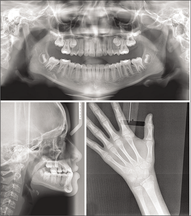 Initial radiographic images.